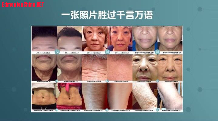 nerium wz2.png